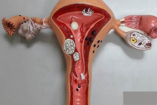 女性子宫内膜的厚度是否影响试管婴儿的成功率如何改善子宫内膜