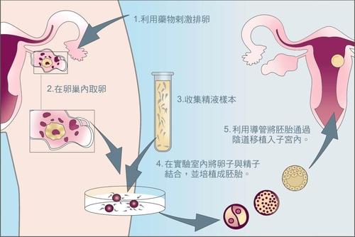 上海40岁供卵费用-昭通市试管婴儿诊所，成功率最高。