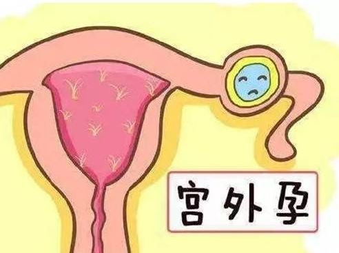 深圳借卵试管助孕哪家机构好：试管婴儿移植后也可能发生宫外孕，这些是宫外孕的主要原因